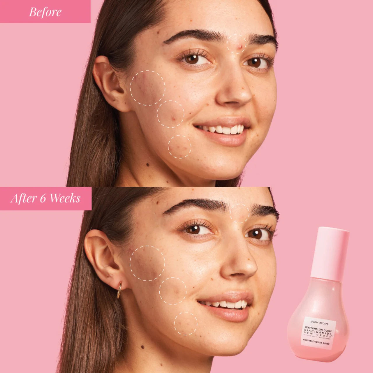 Watermelon Glow Niacinamide Dew Drops Serum 40ml - Glow Recipe