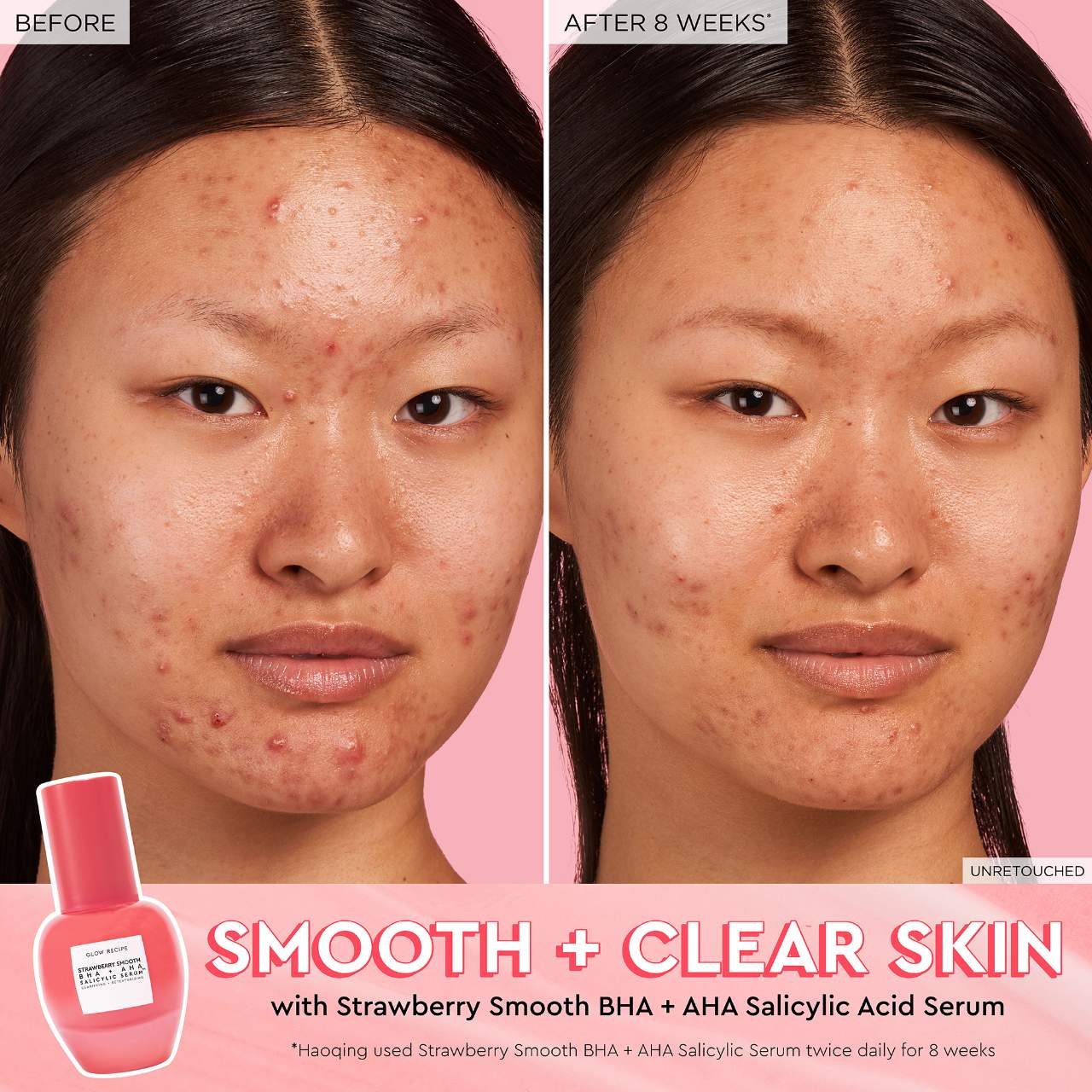 Suero de ácido salicílico BHA + AHA - Glow Recipe