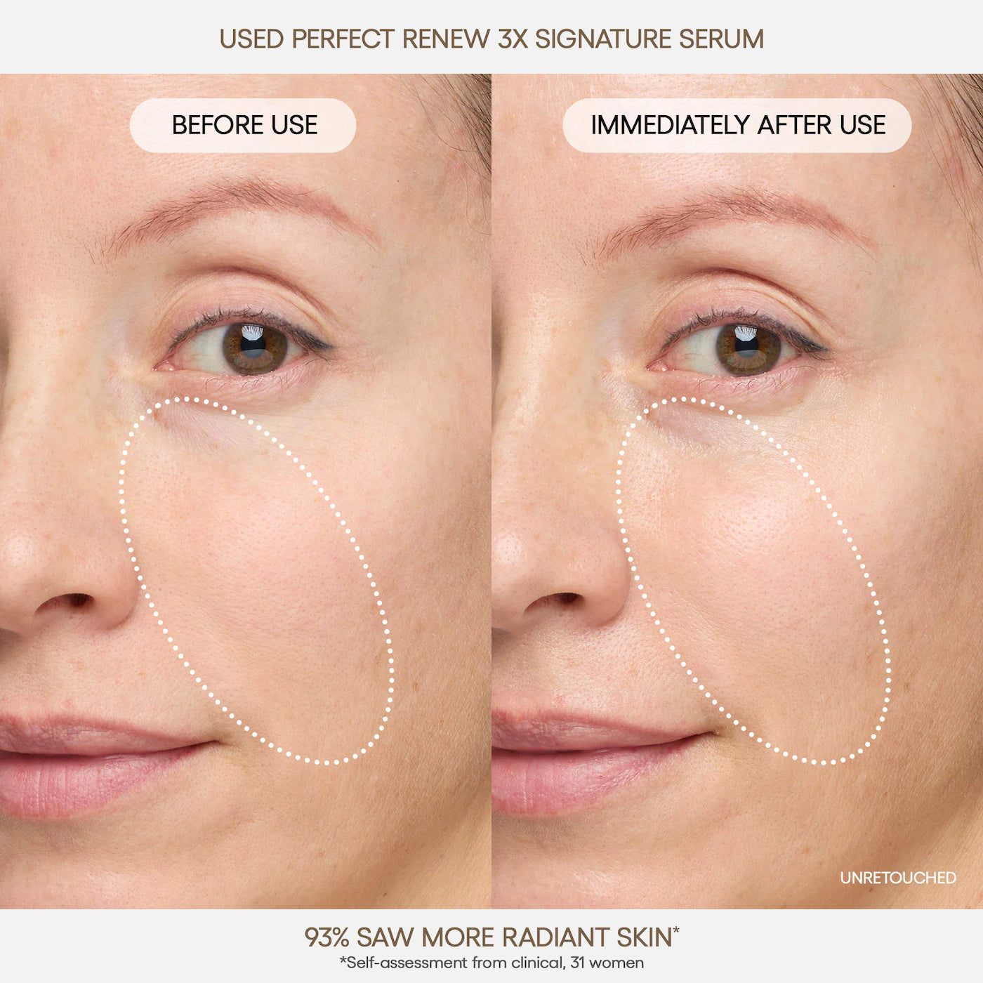 Perfect Renew 3x Signature Serum Advanced for Anti-Aging, Firming & Lifting - Laneige