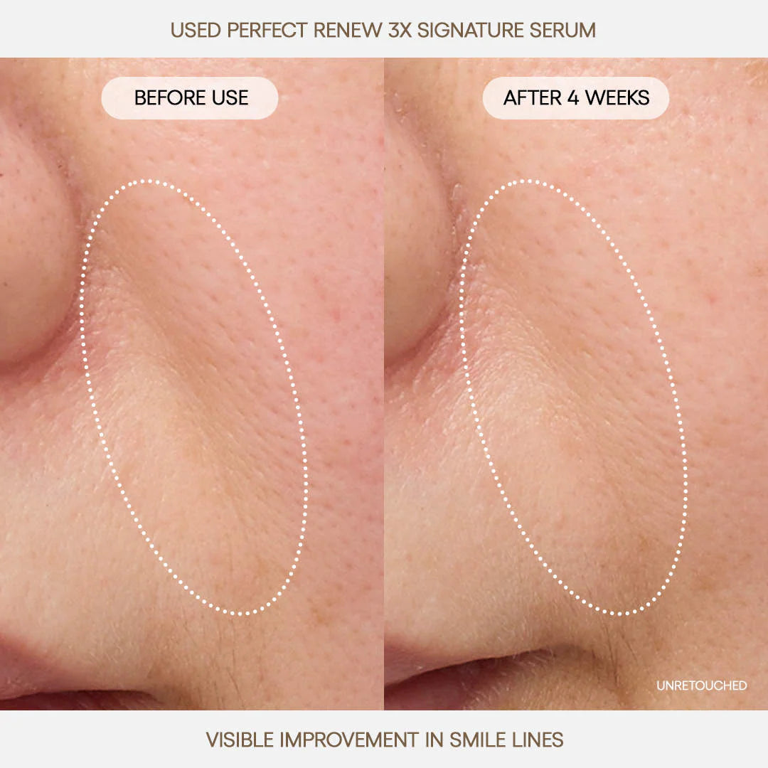 Perfect Renew 3x Signature Serum Advanced for Anti-Aging, Firming & Lifting - Laneige